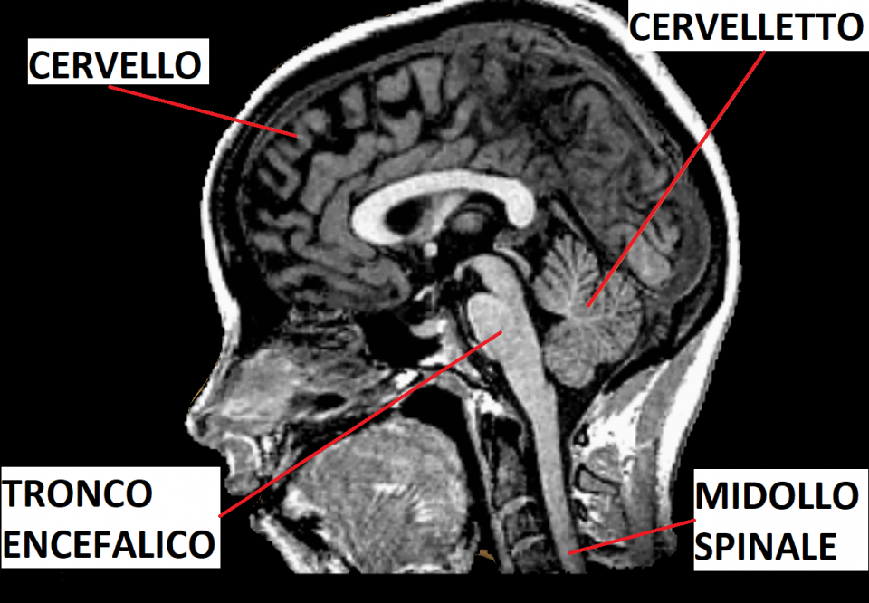 Immagine TAC della sezione sagittale del sistema nervoso centrale
